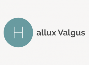 Hallux Valgus