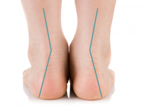 Supination